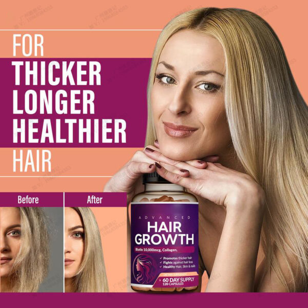 120 capsules，24-in-1 Advanced Hair Growth Vitamins | Biotin 10,000mcg, Collagen, Patented OptiMSM, goMCT, Saw Palmetto | Naturally Regrow Stronger & Healthier Hair, Skin and Nails | Stops Hair Loss | 60 Day Supply - 图片 5